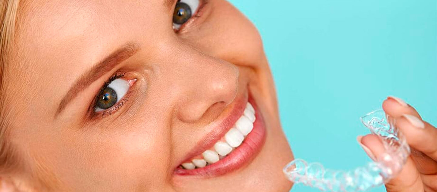 Gouttière d'alignement dentaire invisible (scan intra-oral, pose et suivi par un orthodontiste spécialiste)