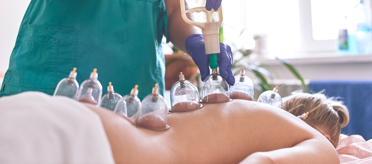 Cupping thérapie (ventouses) à domicile