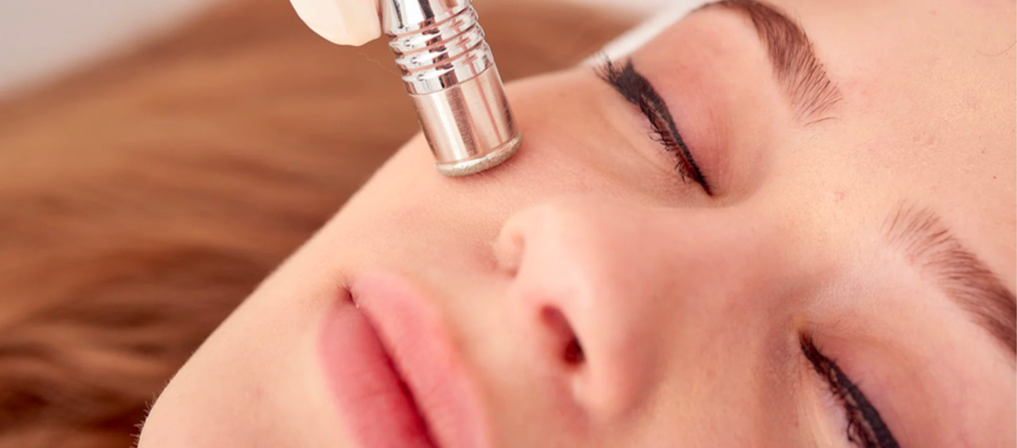 Soin du visage par microneedling 1 ou 3 séances