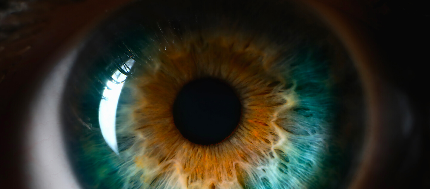 Photo de votre Iris encadrée 