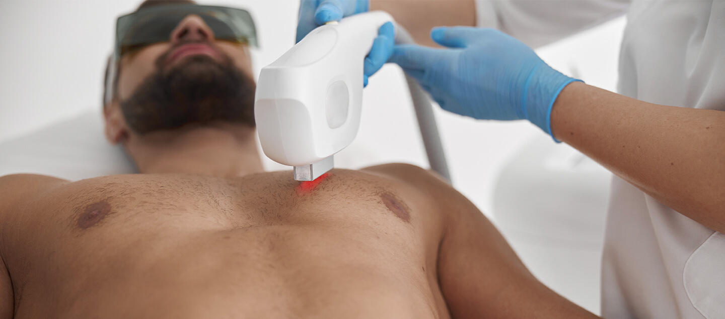 Épilation définitive au Laser Diodes pour Homme - 3 ou 5 séances à choix