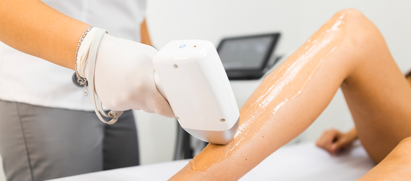 Épilation définitive au laser à diodes sur zone au choix