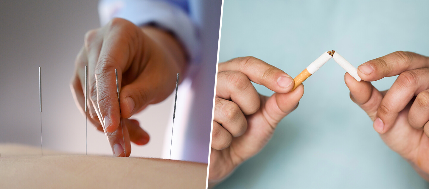 Arrêtez de fumer grâce à l'Acupuncture - 1 ou 3 séances