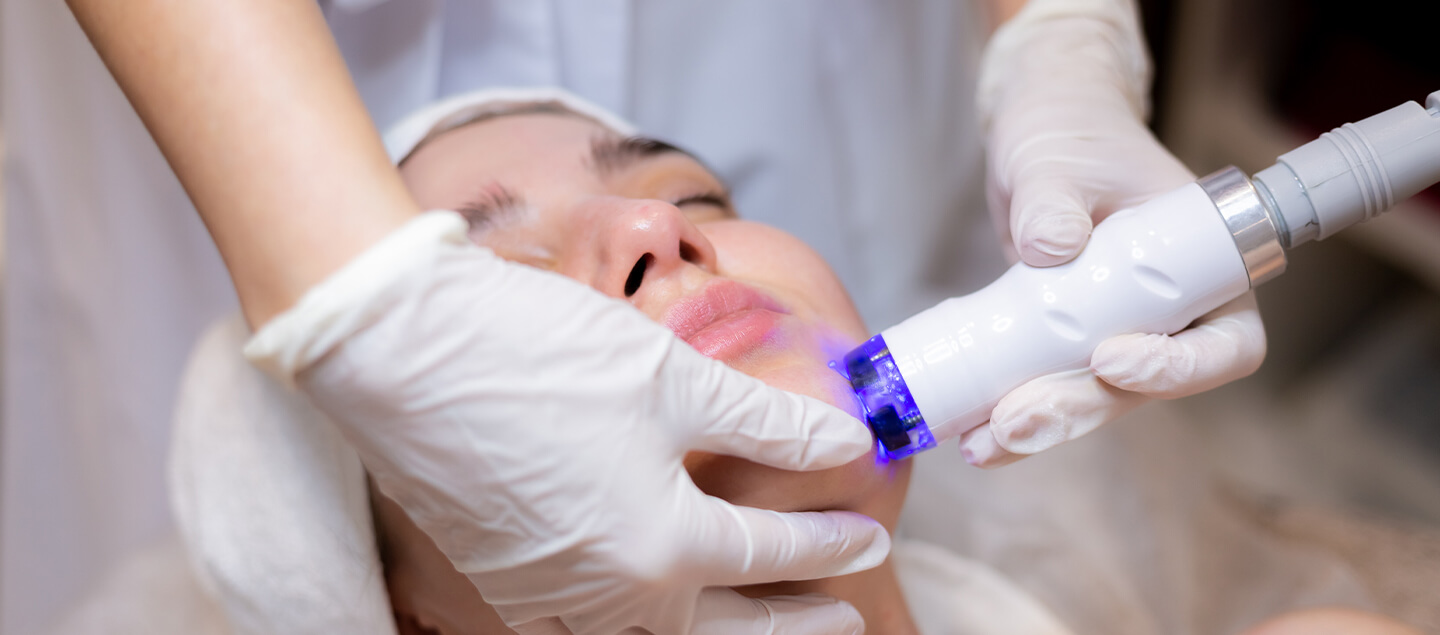 Traitement correcteur du visage par Laser vasculaire