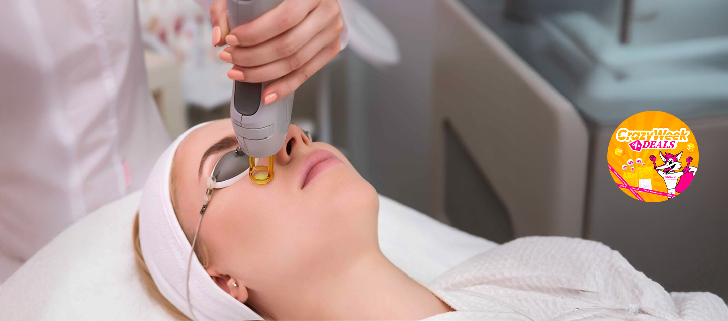 Traitement de la peau Laser Erbium Glass