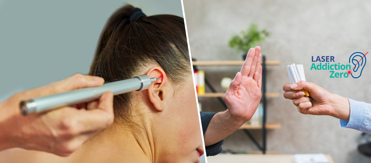 Programme Stop Tabac par méthode du laser à froid