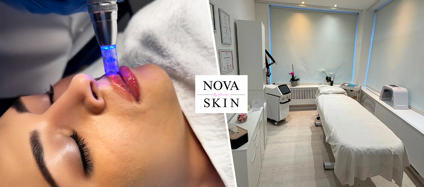 Soin Hydra Lips (avec ou sans LED)