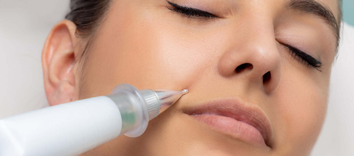 Soin du visage Rajeunissant Plasma Pen - Zone au choix