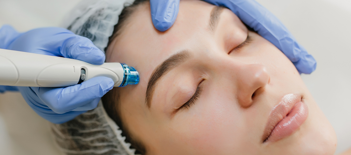 Soin du visage Microneedling - 1 ou 3 séances