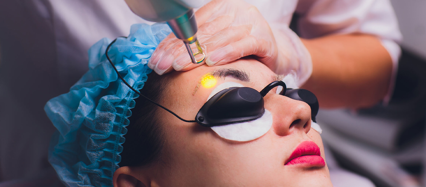 Détatouage des sourcils