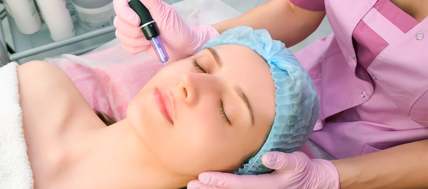 1 ou 3 séances de microneedling