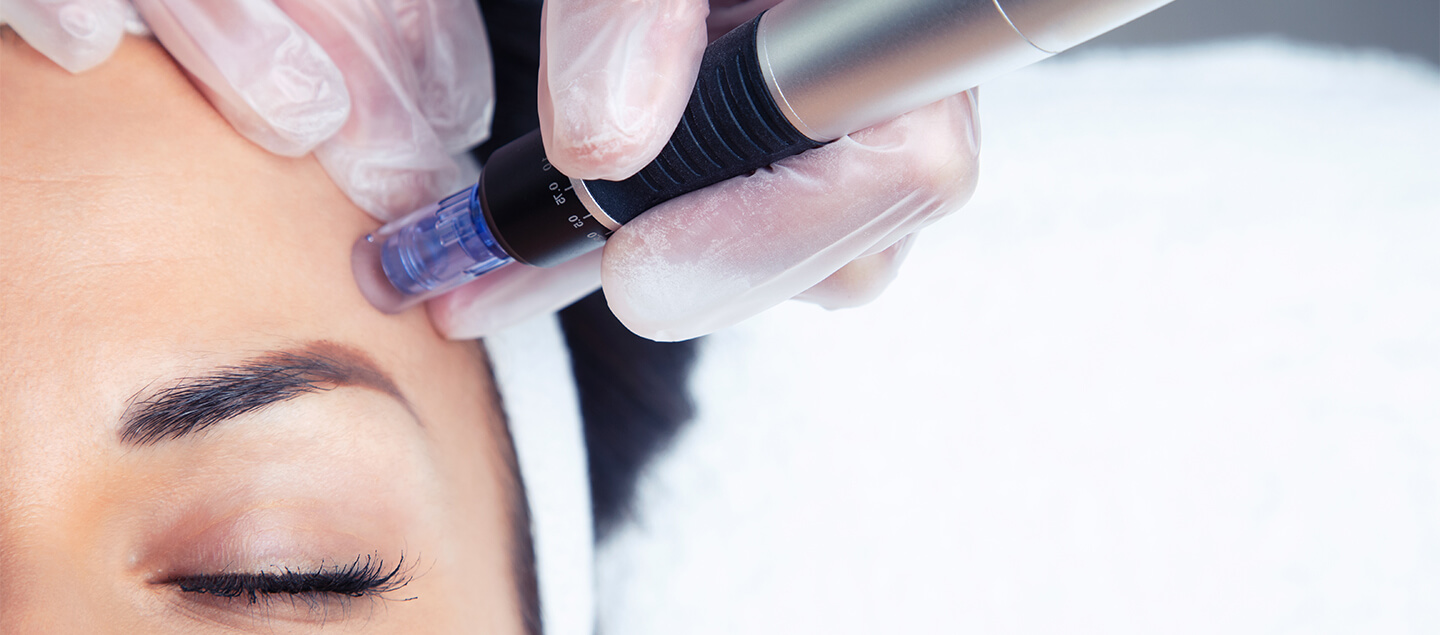 Soin du visage avec Microneedling