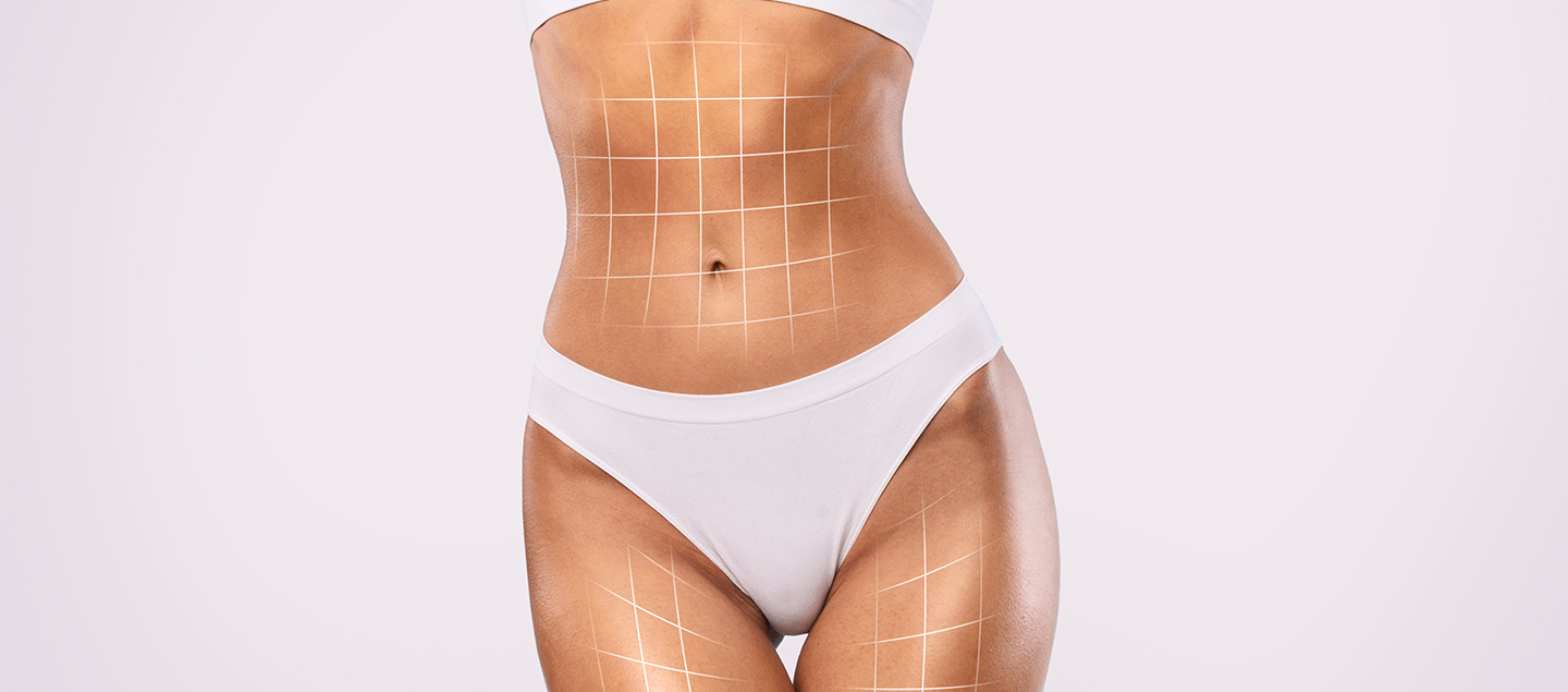 Soin amincissant avec Cavitation et Pressothérapie - 1 ou 3 séances