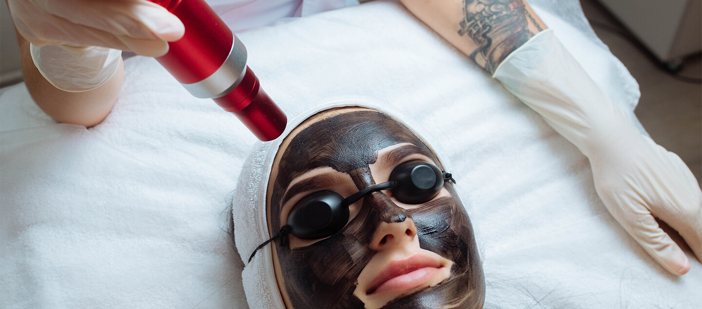 Peeling au carbone - Hollywood Carbon Peel