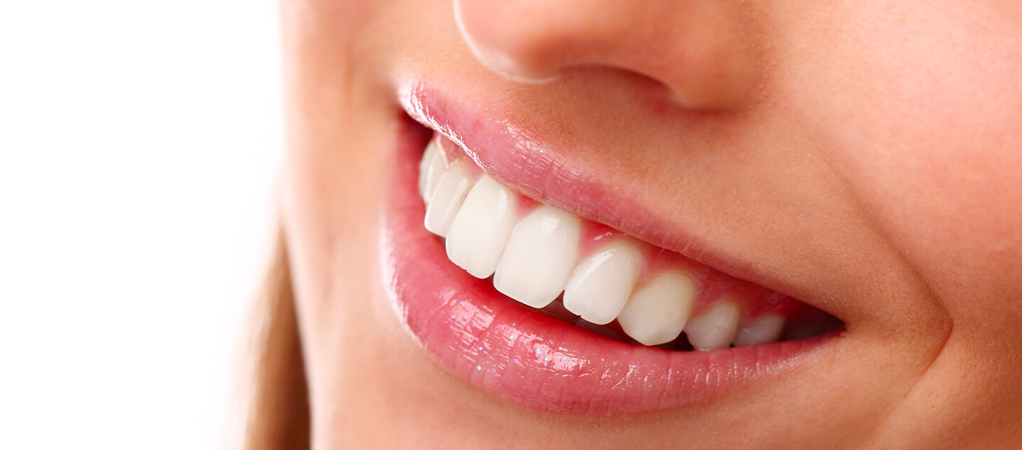 Blanchiment dentaire Smile'Up au choix
