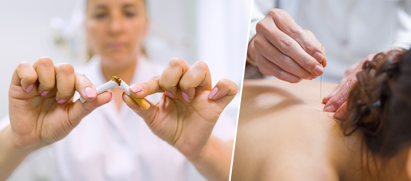 Arrêtez de fumer grâce à l'acupuncture - 1 ou 3 séances