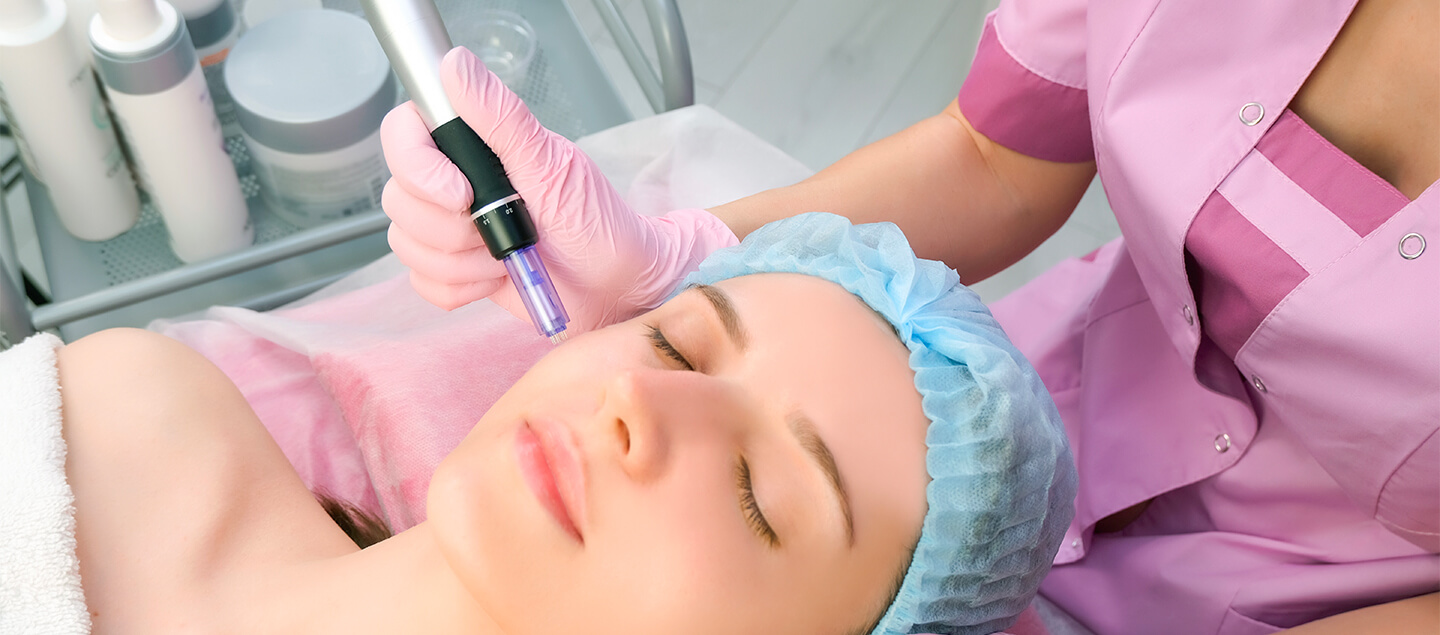 Soin du visage par Microneedling - 1 ou 3 séances