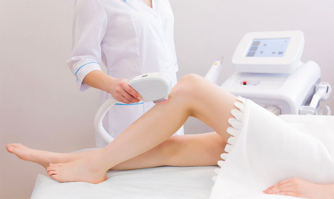 Séance(s) d'épilation laser sur zones Realdeals.ch