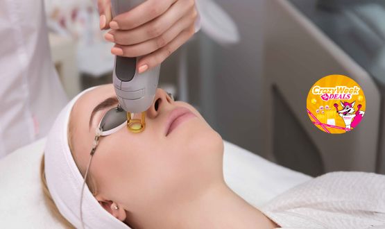 Traitement de la peau Laser Erbium Glass