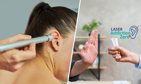 Programme Stop Tabac par méthode du laser à froid