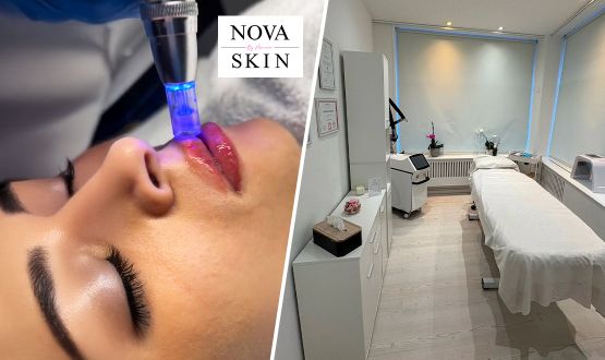 Soin Hydra Lips (avec ou sans LED)