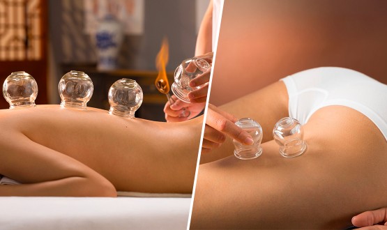 Massage thérapeutique du Dos ou du Dos et des Jambes avec pose de Ventouses chinoises