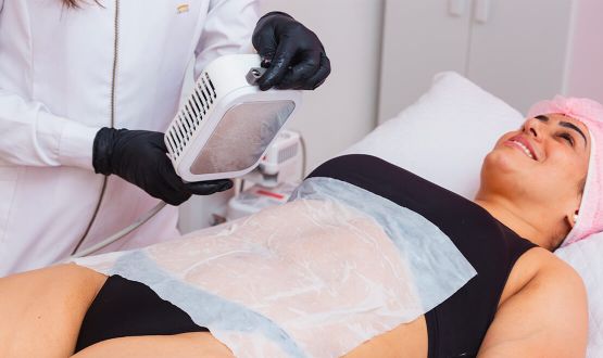 Cryolipolyse sur zone au choix - 1 ou 3 séances 