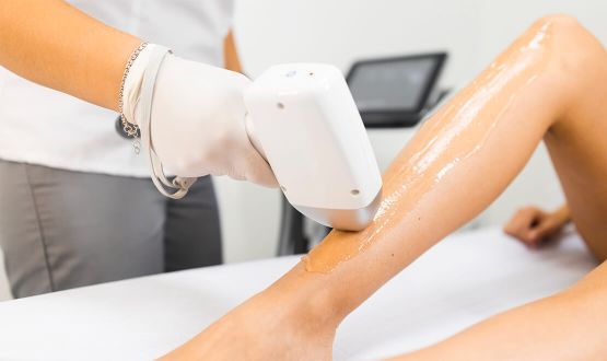 Épilation définitive au laser à diodes sur zone au choix