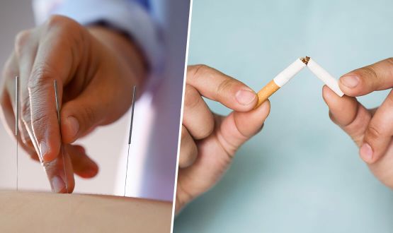 Arrêtez de fumer grâce à l'Acupuncture - 1 ou 3 séances