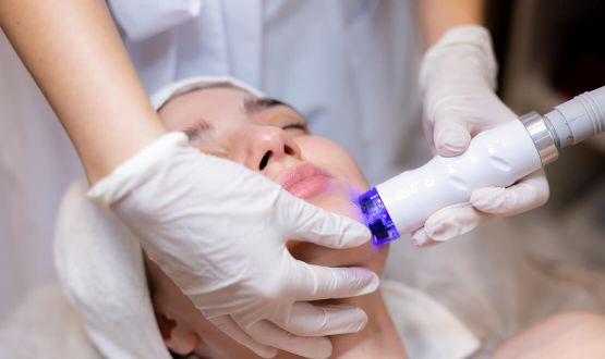 Traitement correcteur du visage par Laser vasculaire