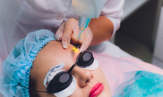 Détatouage des sourcils par laser Picoseconde