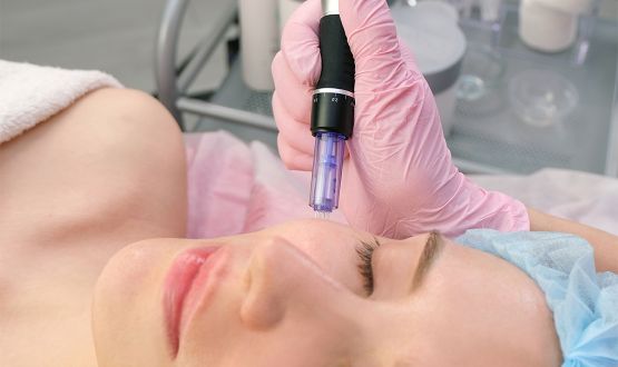 Soin régénérant par Microneedling - 1 ou 3 séances
