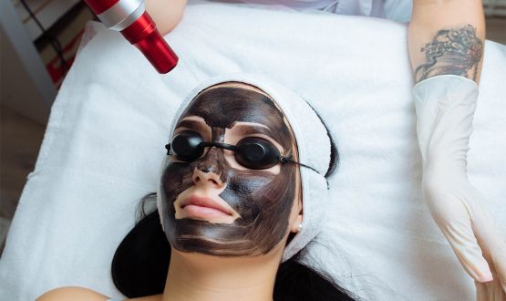Peeling doux corporel au Carbon Laser Peel 