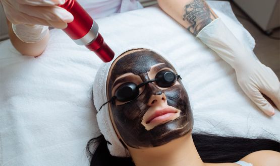 Peeling doux corporel au Carbon Laser Peel 