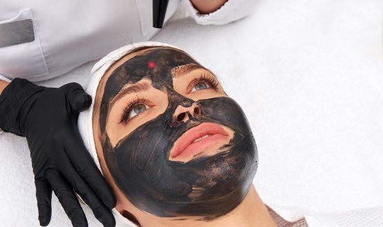 Peeling Hollywoodien au Laser carbon