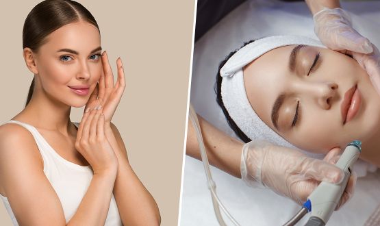 Soin du visage Microneedling et/ou BB glow - 1 ou 3 séances