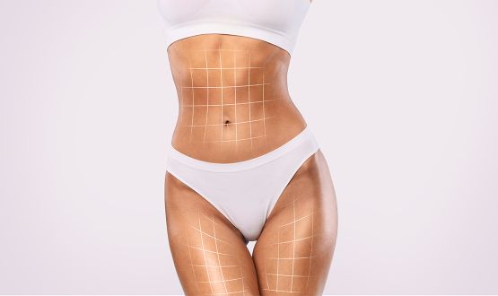 Soins raffermissant du corp par Radiofréquence avec Drainage lymphatique  - 1 ou 3 séances
