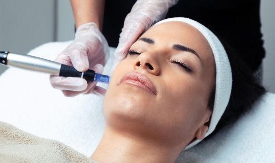 Microneedling avec collagène et Luminothérapie