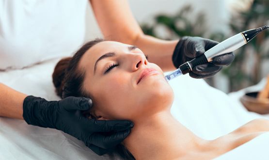 Soin du visage Microneedling by Dermatude - 1, 2 ou 3 séances
